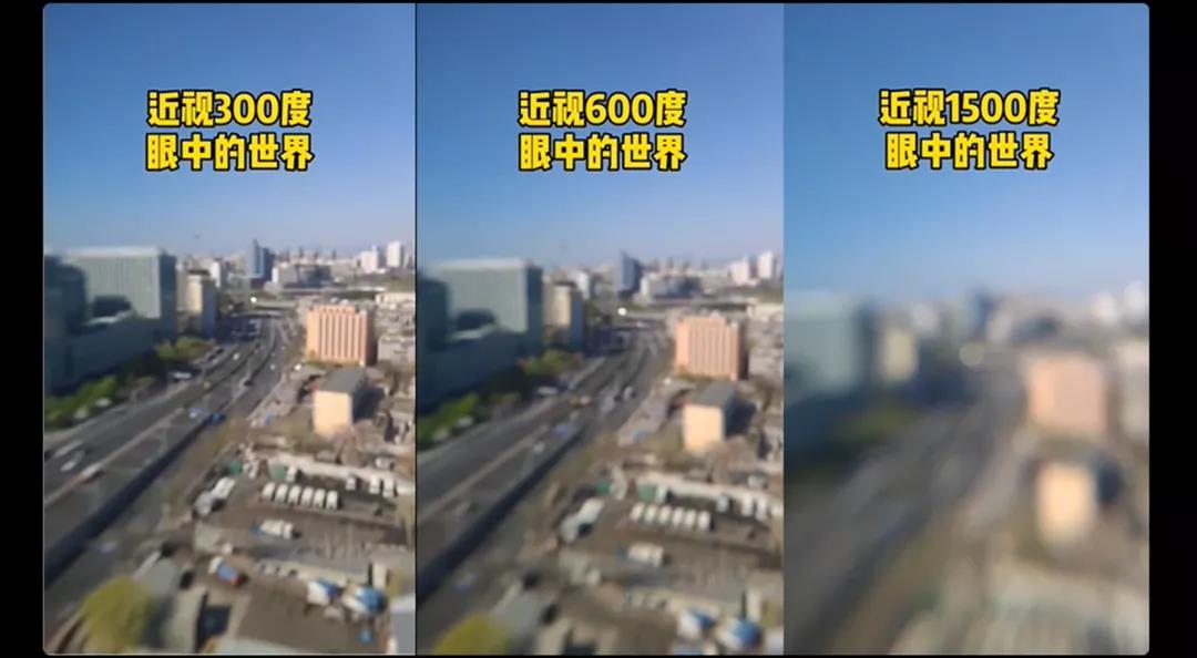 中卫眼科：近视长期戴框架眼镜有什么危害？(图1)